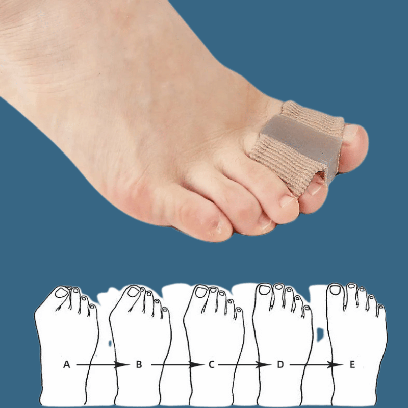 Zole™ Bunion Corrector Gel Insole